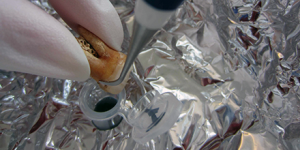 plaque dentaire ADN prélèvement